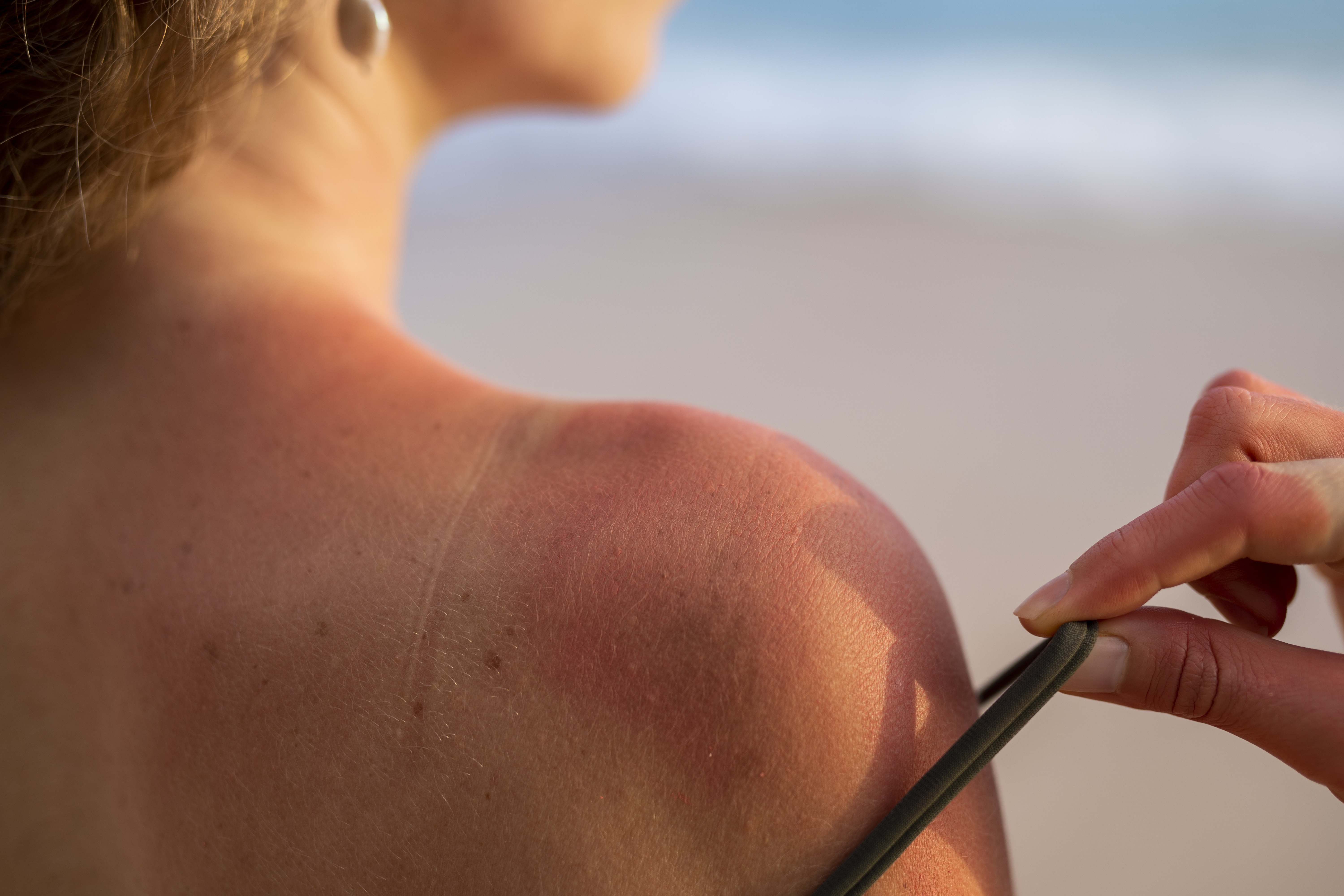 How UV Levels in Australia Affect Your Skin (And Why Your Routine Needs to Change)